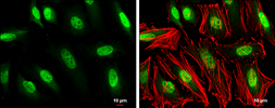 Anti-GTF2H1 antibody [N1C1] used in Immunocytochemistry/ Immunofluorescence (ICC/IF). GTX111804