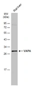 Anti-VAPA antibody [N1N3] used in Western Blot (WB). GTX111859