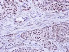 Anti-BCL2L10 antibody [N2C2], Internal used in IHC (Paraffin sections) (IHC-P). GTX111872
