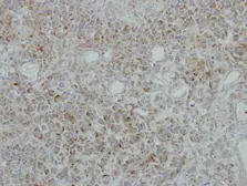 Anti-NDUFB5 antibody used in IHC (Paraffin sections) (IHC-P). GTX111880