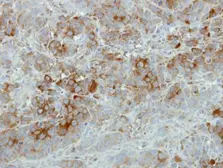 Anti-SFRP2 antibody [C2C3], C-term used in IHC (Paraffin sections) (IHC-P). GTX111892