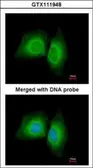 Anti-MARK1 antibody [N1N2], N-term used in Immunocytochemistry/ Immunofluorescence (ICC/IF). GTX111948