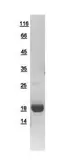 Human GMF Beta protein, His tag. GTX111991-pro