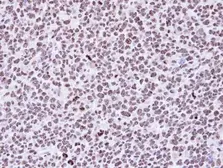 Anti-p53DINP1 antibody [N1N2], N-term used in IHC (Paraffin sections) (IHC-P). GTX112066