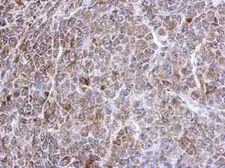 Anti-TXNRD2 antibody used in IHC (Paraffin sections) (IHC-P). GTX112199