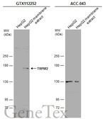 Anti-TRPM2 antibody [N1N2-2], N-term used in Western Blot (WB). GTX112252