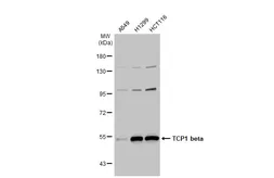 Anti-TCP1 beta antibody [C1C3] used in Western Blot (WB). GTX112283