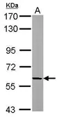 Anti-beta Adducin antibody [N1C1] used in Western Blot (WB). GTX112338