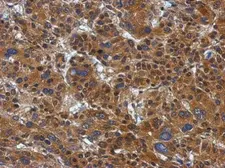 Anti-ATP citrate lyase antibody [N1N2], N-term used in IHC (Paraffin sections) (IHC-P). GTX112387