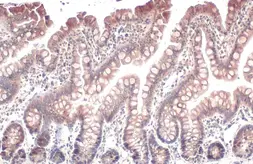 Anti-ACSL3 antibody used in IHC (Paraffin sections) (IHC-P). GTX112431