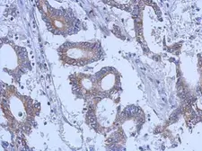 Anti-Cytokeratin 31 antibody [N3C3] used in IHC (Paraffin sections) (IHC-P). GTX112529