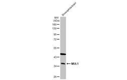 Anti-MUL1 antibody used in Western Blot (WB). GTX112673