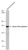 Anti-alpha 2 Macroglobulin antibody [N2N3] used in Western Blot (WB). GTX112856