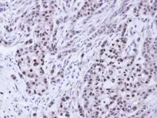 Anti-Bag1 antibody [N2C3] used in IHC (Paraffin sections) (IHC-P). GTX112873
