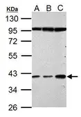 Anti-Haptoglobin antibody used in Western Blot (WB). GTX112962