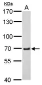 Anti-cIAP2 antibody [C1C3] used in Western Blot (WB). GTX113128