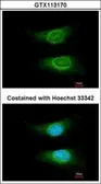 Anti-CD55 antibody [N1C2] used in Immunocytochemistry/ Immunofluorescence (ICC/IF). GTX113170