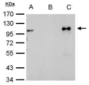 Anti-Glucocorticoid Receptor antibody used in Immunoprecipitation (IP). GTX113208
