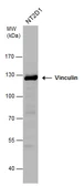 Anti-Vinculin antibody [N1N3] used in Western Blot (WB). GTX113294