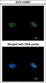Anti-BCCIP antibody used in Immunocytochemistry/ Immunofluorescence (ICC/IF). GTX113357