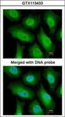 Anti-FANCA antibody [N1], N-term used in Immunocytochemistry/ Immunofluorescence (ICC/IF). GTX113433