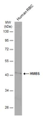Anti-HMBS antibody [N2C3] used in Western Blot (WB). GTX113460