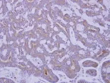 Anti-IGFBP2 antibody used in IHC (Paraffin sections) (IHC-P). GTX113471