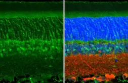 Anti-CRALBP antibody [N2C3] used in IHC (Paraffin sections) (IHC-P). GTX113541