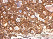 Anti-SULT1A1 antibody used in IHC (Paraffin sections) (IHC-P). GTX113560