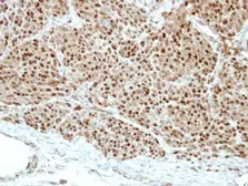 Anti-Pirin antibody used in IHC (Paraffin sections) (IHC-P). GTX113584