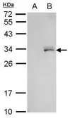 Anti-GFP antibody (HRP) used in Western Blot (WB). GTX113618-01