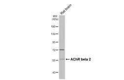 Anti-AChR beta 2 antibody [N1C1] used in Western Blot (WB). GTX113654