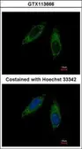 Anti-CYP2C8 antibody used in Immunocytochemistry/ Immunofluorescence (ICC/IF). GTX113666