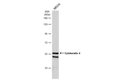 Anti-Cytokeratin 4 antibody used in Western Blot (WB). GTX113764