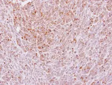 Anti-Laminin gamma 2 antibody [N3C1], Internal used in IHC (Paraffin sections) (IHC-P). GTX113765