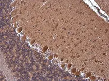 Anti-Rap1GAP antibody [N2C2], Internal used in IHC (Paraffin sections) (IHC-P). GTX113821