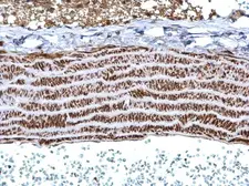 Anti-Tropomyosin 1 antibody used in IHC (Paraffin sections) (IHC-P). GTX113857