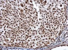 Anti-ALY antibody used in IHC (Paraffin sections) (IHC-P). GTX113917