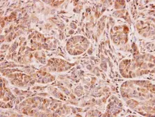 Anti-NAT2 antibody [N1C2] used in IHC (Paraffin sections) (IHC-P). GTX114051