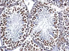 Anti-EWSR1 antibody used in IHC (Paraffin sections) (IHC-P). GTX114069
