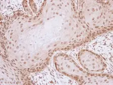 Anti-Livin antibody used in IHC (Paraffin sections) (IHC-P). GTX114132