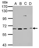 Anti-GGA1 antibody used in Western Blot (WB). GTX114175