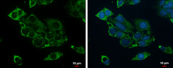 Anti-ACADSB antibody used in Immunocytochemistry/ Immunofluorescence (ICC/IF). GTX114231