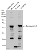 Anti-Calsequestrin 1 antibody used in Western Blot (WB). GTX114304