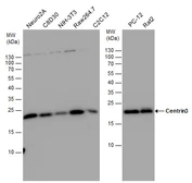 Anti-Centrin 3 antibody used in Western Blot (WB). GTX114317