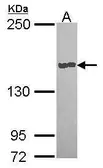 Anti-Carboxypeptidase D antibody [N2N3] used in Western Blot (WB). GTX114335