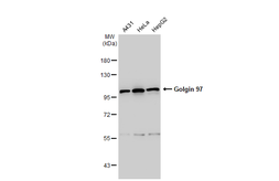 Anti-Golgin 97 antibody [C2C3], C-term used in Western Blot (WB). GTX114445