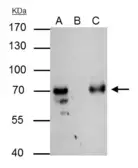 Anti-TFIIF antibody used in Immunoprecipitation (IP). GTX114455