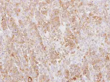Anti-L-Plastin antibody [C1C3] used in IHC (Paraffin sections) (IHC-P). GTX114524