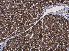 Anti-MGST1 antibody used in IHC (Paraffin sections) (IHC-P). GTX114551
